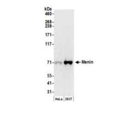 Western Blot: Menin Antibody [Biotin] [NBP1-71794] - Whole cell lysate (50 ug) from HeLa and HEK293T cells prepared using NETN lysis buffer. Antibody: Affinity purified goat anti-Menin antibody used for WB at 0.1 ug/ml. Detection: Chemiluminescence with an exposure time of 30 seconds.